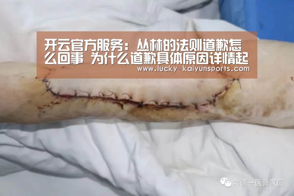 开云官方服务:丛林的法则道歉怎么回事 为什么道歉具体原因详情起底(图4) 开云体育首页